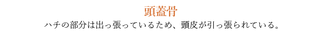 頭蓋骨 - ハチの部分は出っ張っているため、頭皮が引っ張られている。
